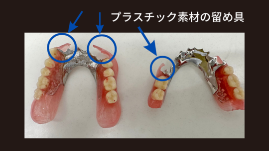 歯科　裁断済み　ノンメタルクラスプデンチャー ノンクラスプデンチャー - 株式会社足利セラミックラボラトリー